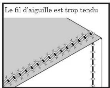 BABY LOCK Triumph - Le fil d'aiguille est trop lâche – - 1