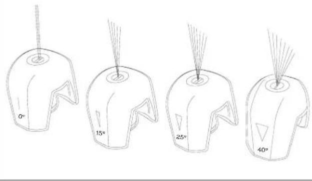 Sun Joe SPX3000XT1BV3 - Rinsing with the Pressure Washer - 1