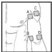 BEURER EM 59 - Relation between electrodes and muscle fibre structures - 1
