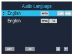 Soundmaster KTD1020 - Audio - 1