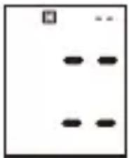 ProfiCare PCBMG 3018 - Supprimer des mesures de la mémoire - 1