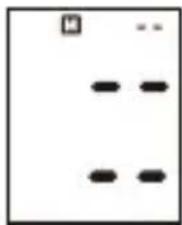 ProfiCare PCBMG 3018 - Gespeicherte Ergebnisse anzeigen - 6