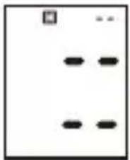 ProfiCare PCBMG 3018 - Borrar mediciones de la memoria - 1