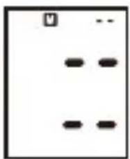 ProfiCare PCBMG 3018 - Deleting Measurements from the Memory - 1