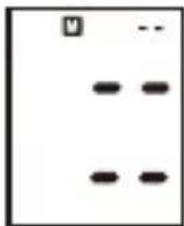 ProfiCare PCBMG 3018 - Удаление измерений из памяти - 1
