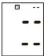 ProfiCare PCBMG 3018 - Tárolt eredmények megjelenítése - 6