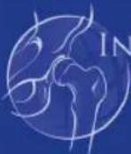 CHICCO Boppy ComfyFit - GARANTIA - 1