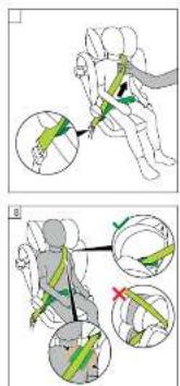 Medical illustration showing a hand performing a laparoscopic procedure with labeled steps and directional arrows indicating motion.