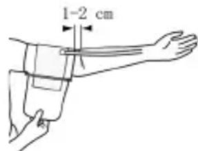 AEG BMG 5677 - COLOCACION DE L BRAZALETE - 1