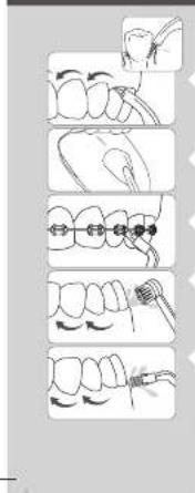 Waterpik WF10 - Embout orthodontique - 3