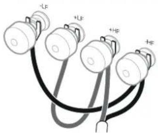 -LF +LF +HF +HF