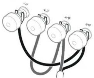 -LF +LF +HF +HC