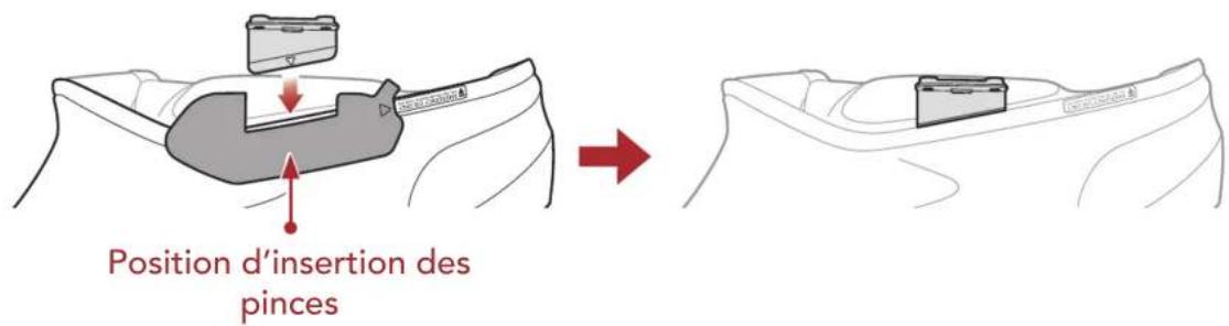 Position d'insertion des pinces