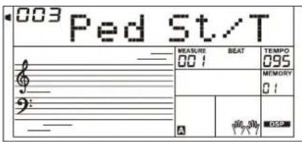 Medeli A810 - Pédale forte ou de sustain (assignable) - 3