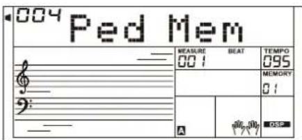 Medeli A810 - Pédale forte ou de sustain (assignable) - 4