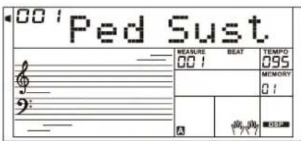Medeli A810 - Pédale forte ou de sustain (assignable) - 1