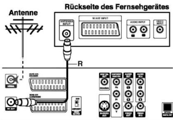 LG DR4810PVL - RF-Koaxialverbindung - 1