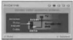 LG DR175KS - Configuration Automatique - 2