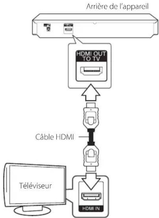 LG BP145 - Raccordements à votre téléviseur - 1