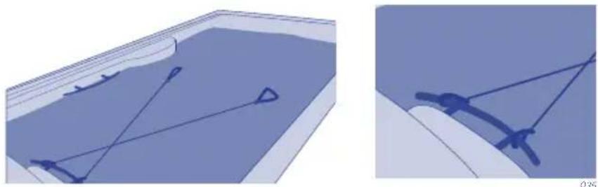 ASTRALPOOL Select E - FIJACIÓN RECOMENDADA PARA LA CUERDA - 1