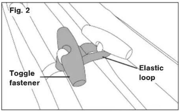 Fig. 2 Toggle fastener Elastic loop