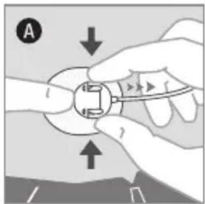 Accu-Chek TenderLink - Отсоединение - 1