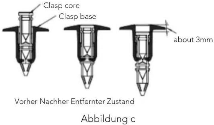 Mestic RTA2500 - ENTFERNEN DES KLEMMSTIFTS - 6