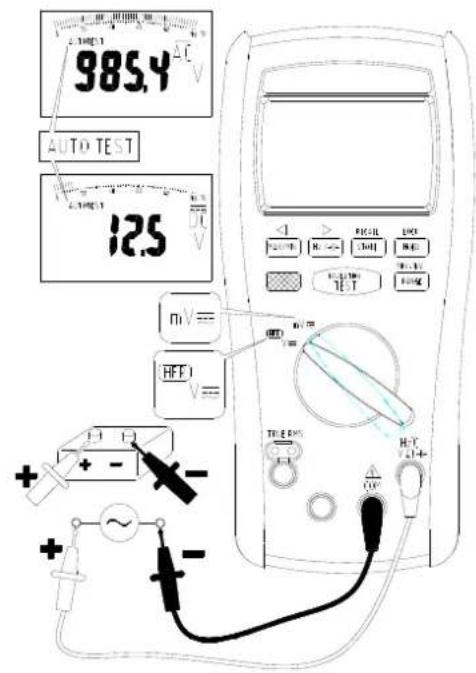 985.4 V AUTO TEST 12.5 V mV= HFP V= TELE RMS HFP CWP