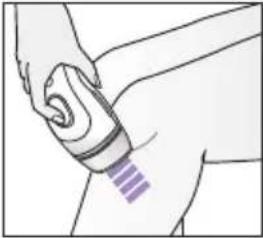 BRAUN Silk·expert Pro 3 PL3012 - Métodos de tratamiento - 2