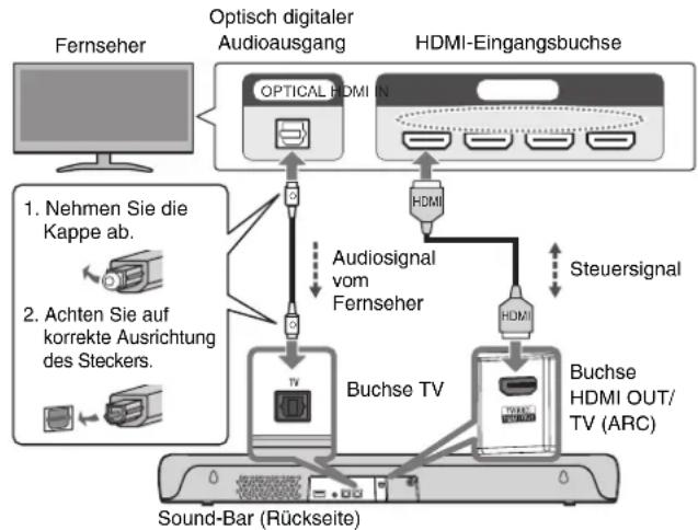 YAMAHA SRC30A - Anschließen eines Fernsehers mit einem HDMI-Kabel (im Fachhandel erhältlich) - 2