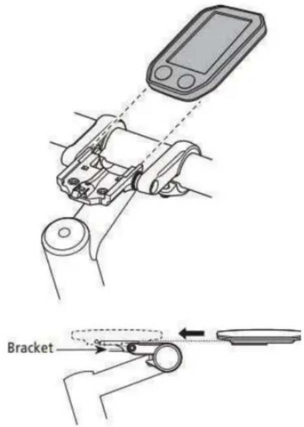 Diagram illustrating a medical device with labeled components and a close-up of the device's internal structure, including a 'Bracket' label.