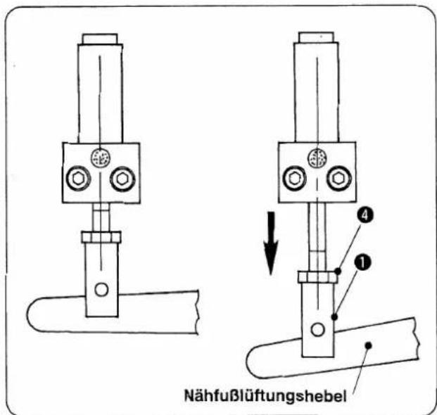Nähfußlüftungshebel