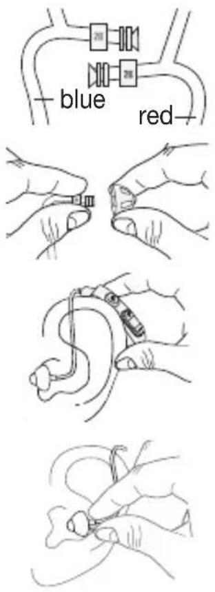 BEURER HA 85 - Adjusting your hearing amplifier - 1