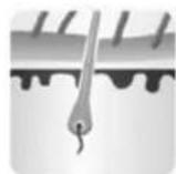 Concept Perfect Skin IL5020 - Tres fases: anágena, catágena y telógena - 1