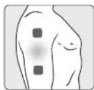 TERRAILLON Trio Care+ - DOLOR EN EL CODO - 1