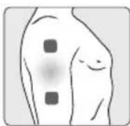 TERRAILLON Trio Care+ - ELBOW PAIN - 1