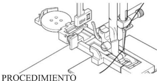 PROCEDIMIENTO