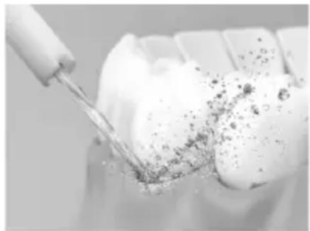 PANASONIC EWDJ11 - Periodontal cep temizligi - 1
