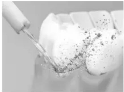 PANASONIC EWDJ11 - Periodontal pocket cleaning - 1