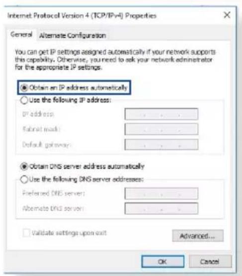 ASUS RTAXE7800 - configurez les paramètres tcp/ip pour l'obtention automatique d'une adresse IP. - 4
