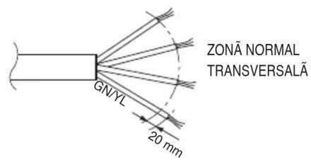 ZONA NORMAL TRANSVERSALÄ GNYL 20 mm