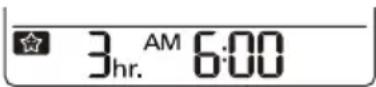 LG UM18FH - Einstellen des Sleep-Timers - 1