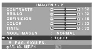 NEC PlasmaSync 61XM4 - Reducción del ruido de la imagen - 1
