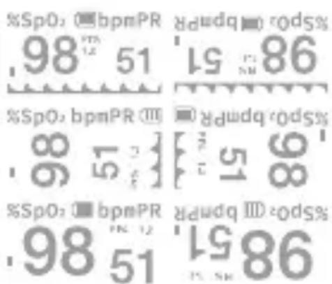 %SpO: ■ bpmPR R_dmpR ■ bpmPR .98 51 86 98 51 86 %SpO: bpmPR ■ bpmPR R_dmpR ■ bpmPR .85 51 86 %SpO: ■ bpmPR R_dmpR ■ bpmPR R_dmpR 0 0% 0 .98 51 86 98 51 86