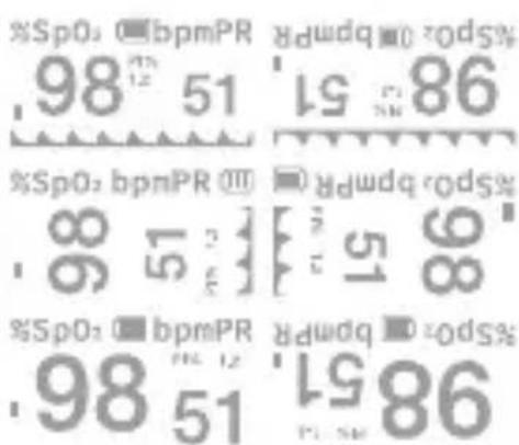 %SpO: ■bpmPR 98 51 %SpO: ■bpmPR 98 51 %SpO: ■bpmPR 98 51 %SpO: ■bpmPR 98 51 %SpO: ■bpmPR 98 51 %SpO: ■bpmPR 98 51 %SpO: ■bpmPR 98 51 %SpO: ■bpmPR 96 51 %SpO: ■bpmPR 96 51 %SpO: ■bpmPR 96 51 %SpO: ■bpmPR 96 51 %SpO: ■bpmPR 96 51 %SpO: ■bpmPR 96 51 %SpO: ■bpmPR 96 51 %SpO: ■cbsprwR 96 51 %SpO: ■cbsprwR 96 51 %SpO: ■cbsprwR 96 51 %SpO: ■cbsprwR 96 51