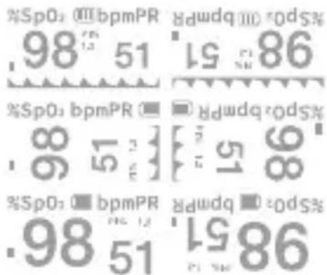 %SpO: 000bpmPR 98 51 86 %SpO: bpmPR 8 51 %SpO: bpmPR 98 51 86 %SpO: bpmPR 8 51 %SpO: bpmPR 98 51 86