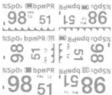 %SpO: ■ bpmPR 98 51, 98 %SpO: ■ bpmPR 86 %SpO: bpmPR 8 51, 8 %SpO: ■ bpmPR 98 51, 98 %SpO: ■ bpmPR 98 51, 98