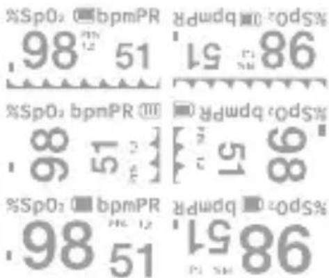 %SpO: 0 bpmPR 98 51 86 %SpO: 0 bpmPR 98 51 86 %SpO: bpmPR 98 51 86 %SpO: 0 bpmPR 98 51 86