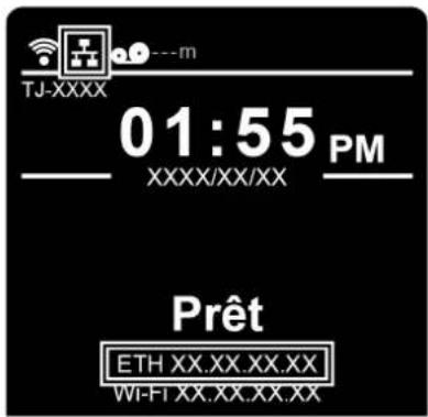 BROTHER TJ4005DN - Paramètres Ethernet - 1