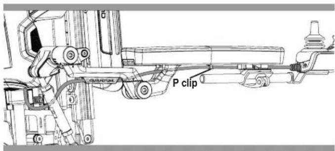 P clip